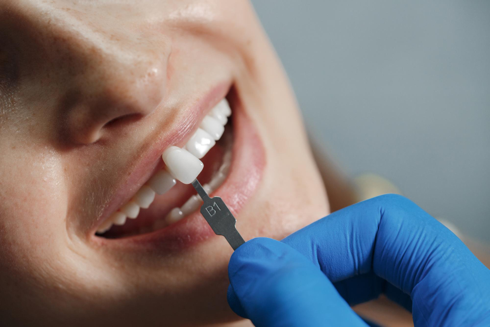 What Does "$399 Dental Implants" Usually Mean